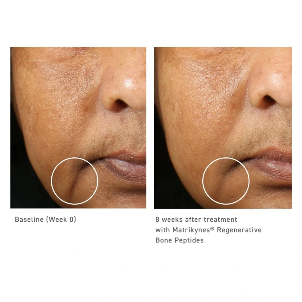 NIB Sweet Chemistry  barrier repairing hydra Serum Infusion 1.0 OZ $160